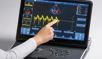 Mão apontando as imagens do coração na tela de um aparelho de ecocardiograma portátil