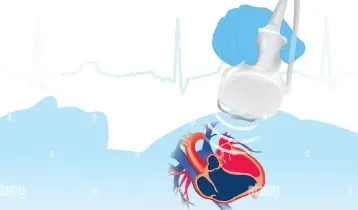 Ilustração do transdutor de ultrassom captando a imagem do coração