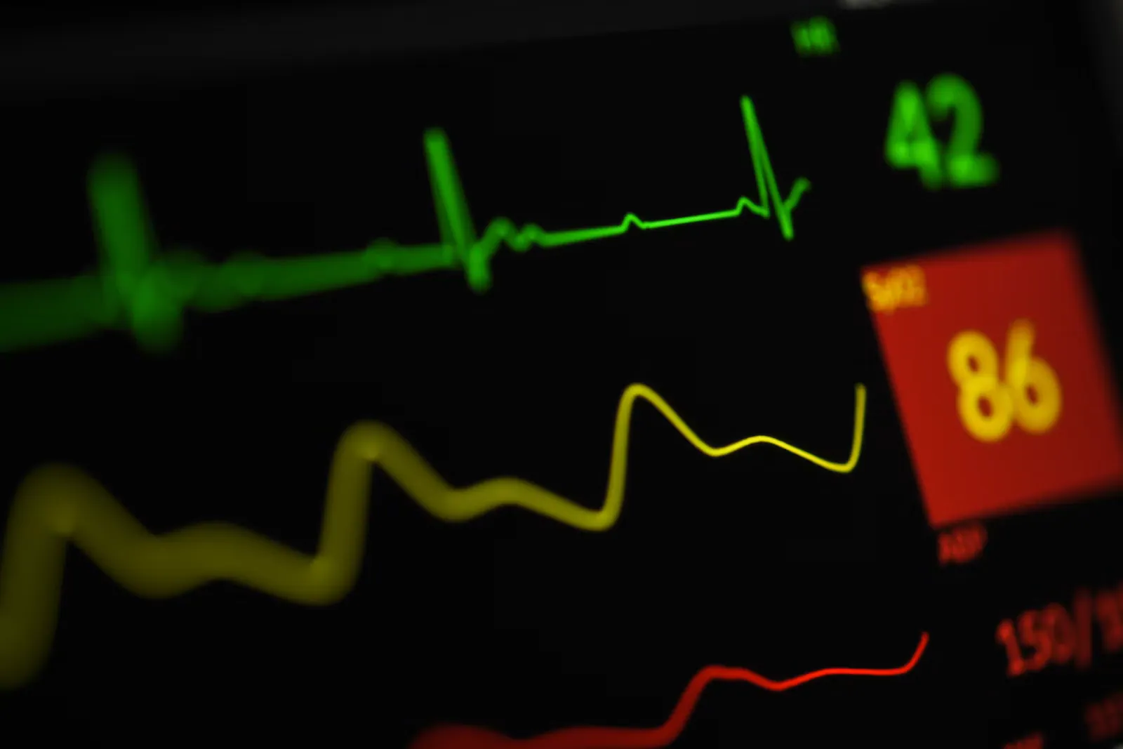 Tela de monitor cardíaco com o traçado do eletrocardiograma e a pressão arterial