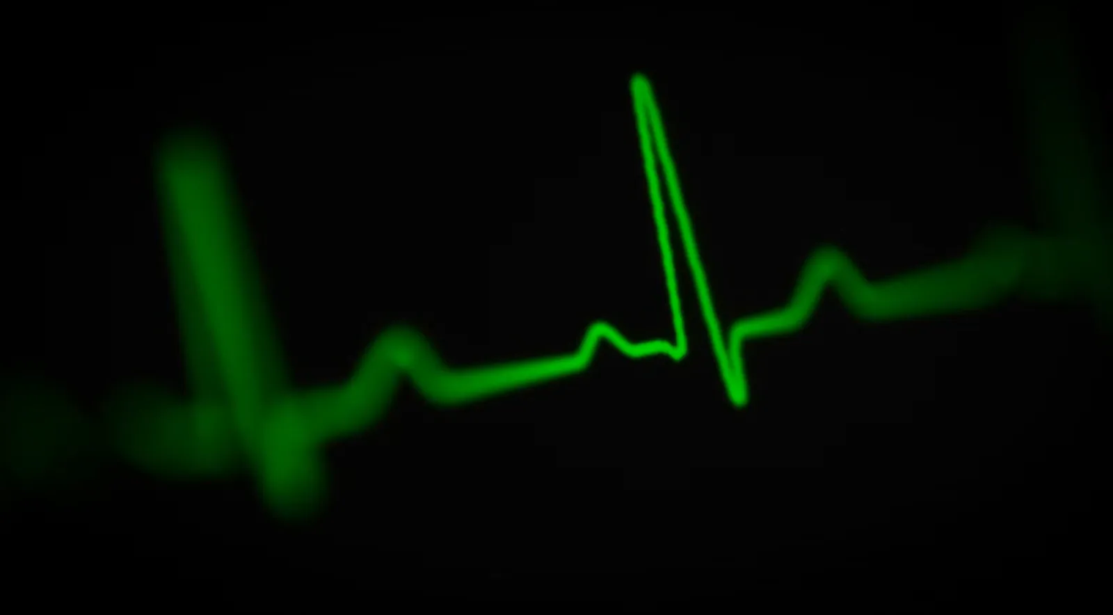 Traçado verde de um eletrocardiograma em tela escura