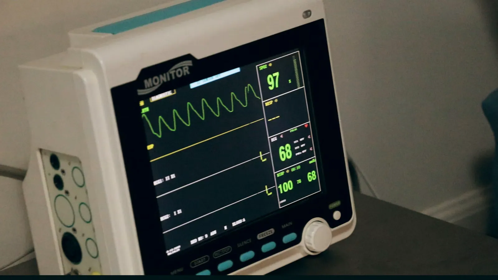 Monitor de sinais vitais exibindo as ondas e os batimentos do paciente